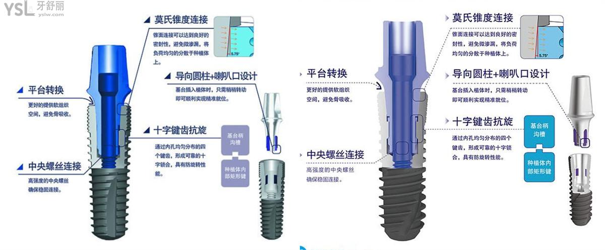 国产威高WEGO种植体