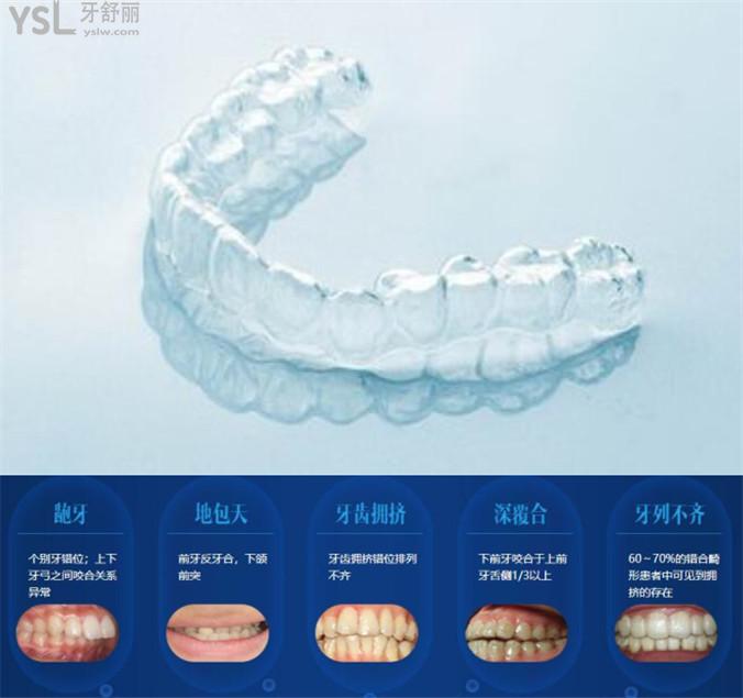 隐适美隐形矫治器多少钱？