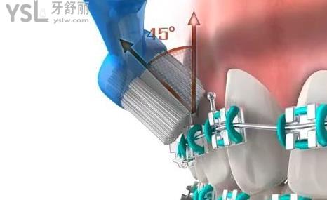 每次吃完东西必须要漱口吗 为什么不建议立马刷牙