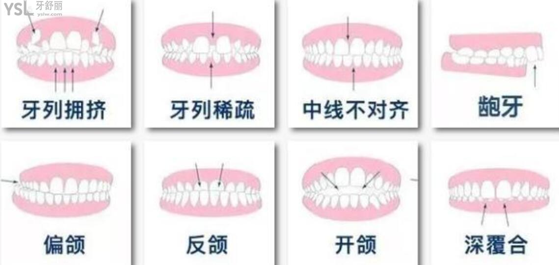 整牙十年后的感受及心得体会