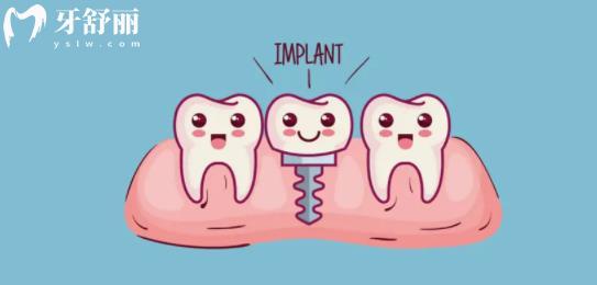 种植牙卡通图