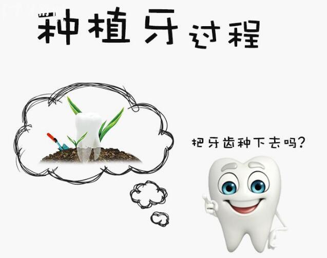 听说青海一颗种植牙仅要三千元,是青海种植牙集采开始了吗.jpg