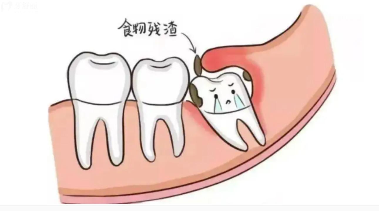 口腔瘘管怎么治疗图片