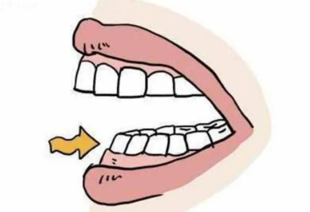 牙齿往里面凹怎么回事?牙齿往里面凹应该怎么办?