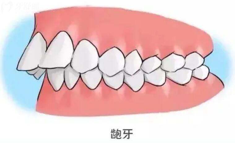 人的牙齿是上下对齐的吗图片?来看看你的牙齿是正常的吗