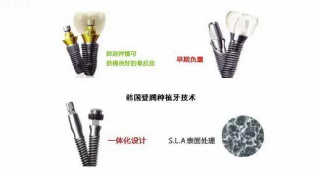 韩国登腾Dentium种植体