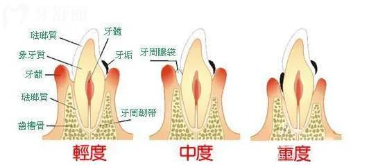 4黄石牙科收费价目表 一般拔牙 补牙 种牙 整牙多少钱？