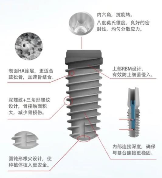 北京大清西格1号种植系统