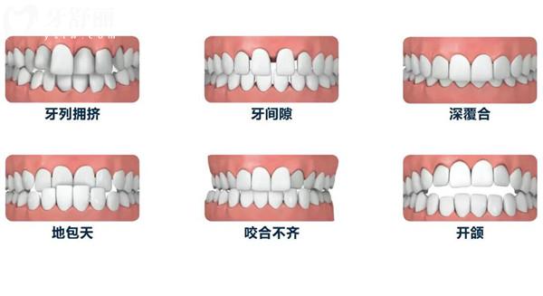 广西河池牙科医院收费标准翻新,种植牙2800元起/牙齿矫正6000元起