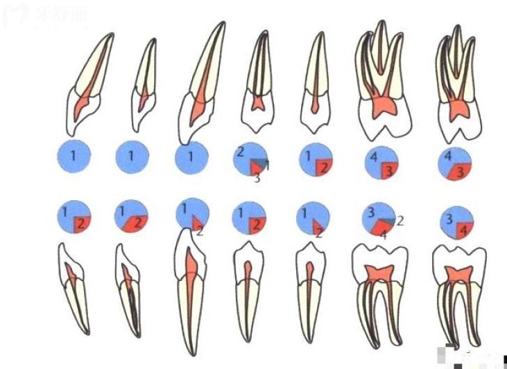 牙齿根管示意图