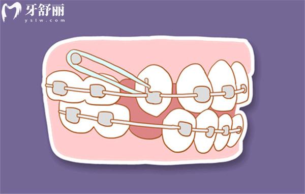 保山口腔医院收费标准表