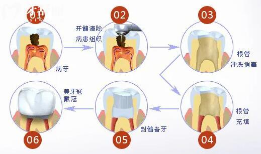 肇庆牙科医院收费标准有变化,现在种植牙2850+,矫正5500+