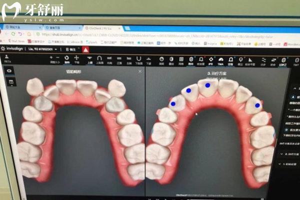 天津爱之和口腔方案设计