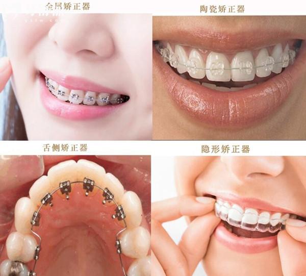 广州暨博口腔收费标准更新,在线查暨博种牙/矫正/拔牙价格明细