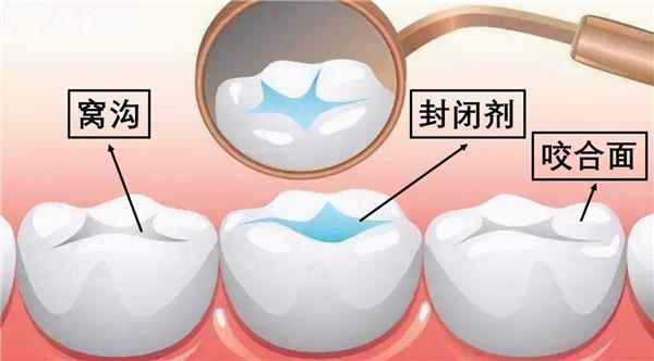 西安诺贝尔牙科地址有哪几家