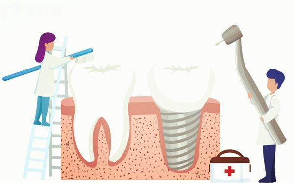 **附属北**腔医院种植牙多少钱