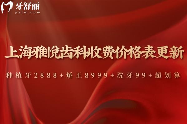 上海雅悦齿科收费价格表更新:种植牙2888+矫正8999+洗牙99+超划算