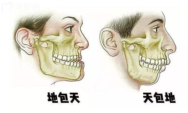 北京大学口腔医院做正颌手术怎么样