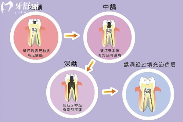 资阳牙科医院收费标准表