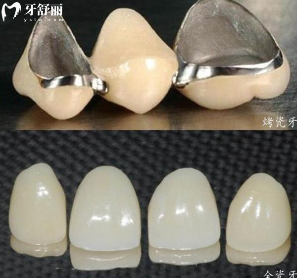 北海牙科收费价目表2024,种植牙2880+牙齿矫正5880+好又便宜