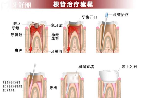 自贡牙科医院收费价目表