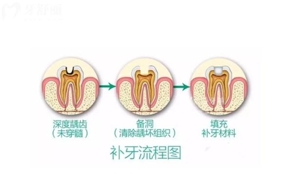 成都金堂县口腔医院收费标准