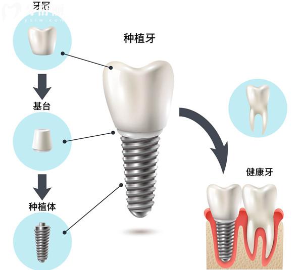 杭州西湖区牙科医院收费标准