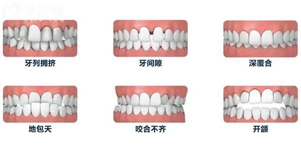 重庆牙博士口腔医院价格表2024,一览种植牙/矫正/拔牙收费贵吗