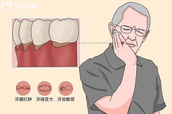 人老了掉牙是自然规律吗
