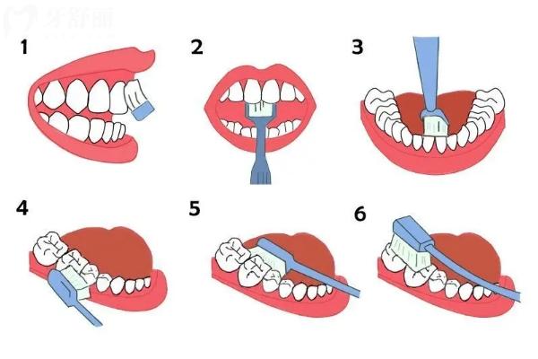 巴氏刷牙法有哪些好处？掌握正确的刷牙方法可预防多种口腔问题