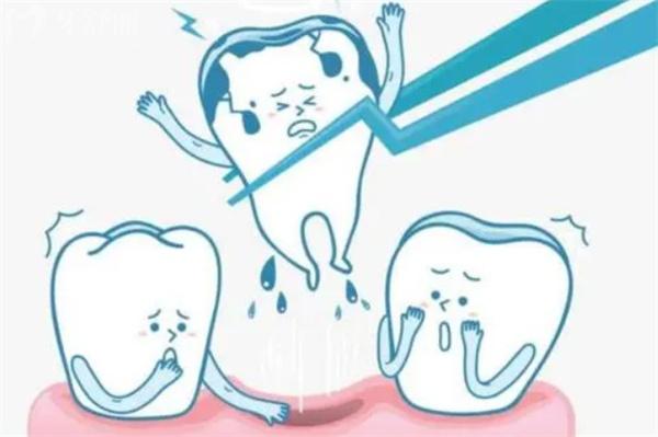 导致牙齿缺失的原因有哪些