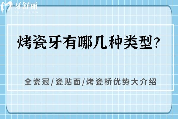 烤瓷牙有哪几种类型？全瓷冠/瓷贴面/烤瓷桥优势大介绍