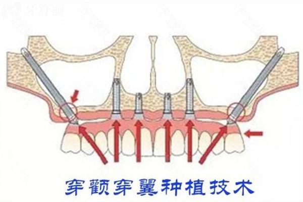 更新桦甸牙科收费价格表:附桦甸牙科诊所哪个好名单及地址