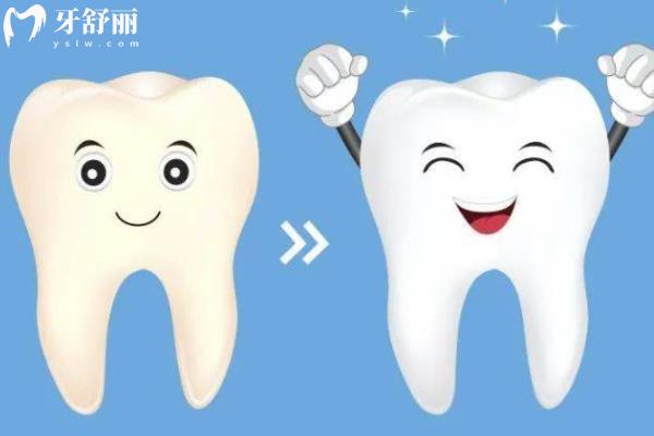 大连牙齿美白哪家好？