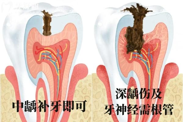 上海牙科医院收费标准表