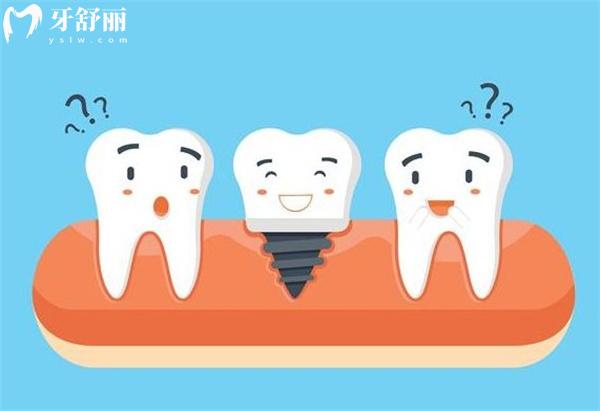 杭州西湖口腔种植牙价格表