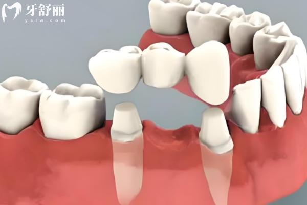 高安牙科收费标准