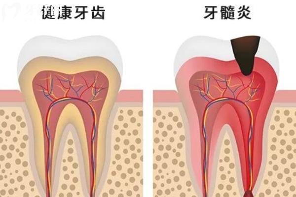 牙疼和压力大有关系吗？