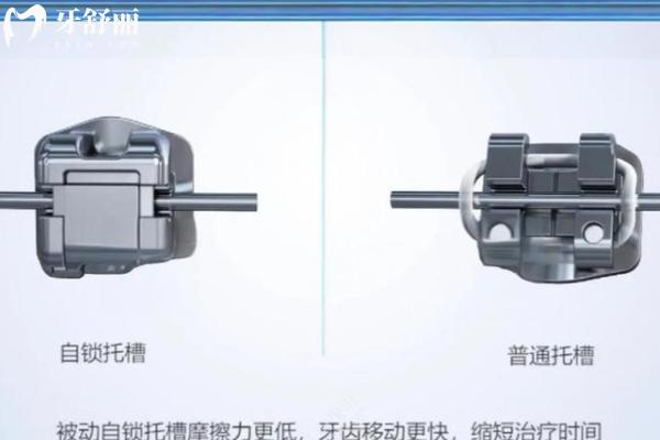 抚顺仕康口腔价目表