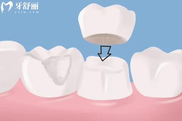 兴国爱洁口腔价目表