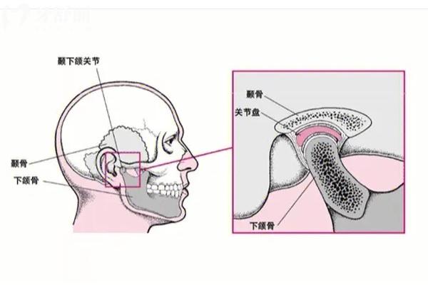 不影响美观的深覆合还需要矫正吗