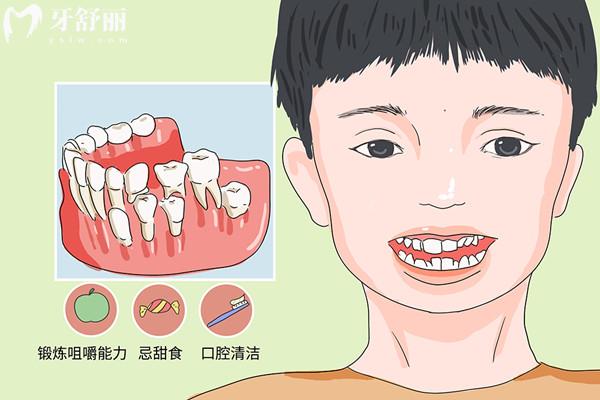 哪些因素导致牙齿不整齐