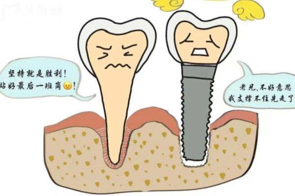 种植牙塞牙是不是正常现象