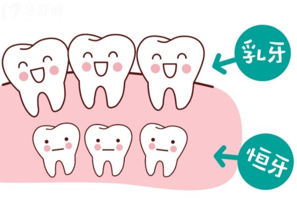 乳牙磕断了一半怎么办？直接拔掉还是修复？