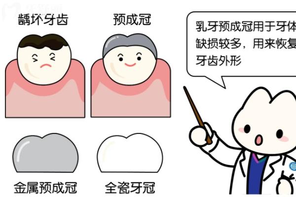 乳牙磕断了一半怎么办？直接拔掉还是修复？