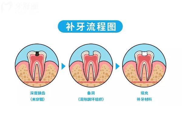 南宁补牙哪家医院好？南宁岭南