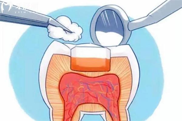 看牙能走医 保报销吗 牙科医疗保险报销范围及流程了解下！