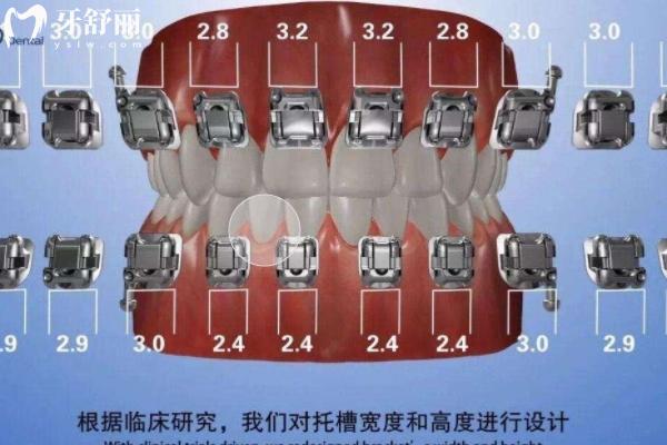 O-eyes欧睛自锁牙套