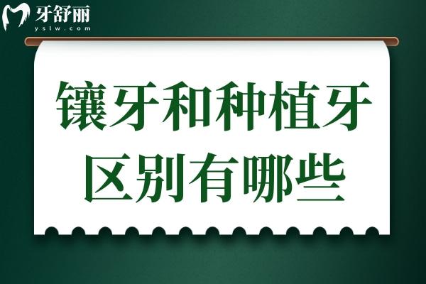 除了价格外，镶牙和种植牙的区别还有哪些？你会选择哪一种呢？