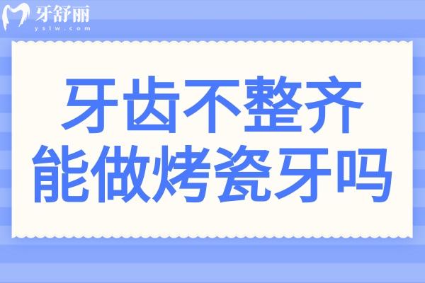 牙齿不整齐能做烤瓷牙吗?镶烤瓷牙的适应症解答分析